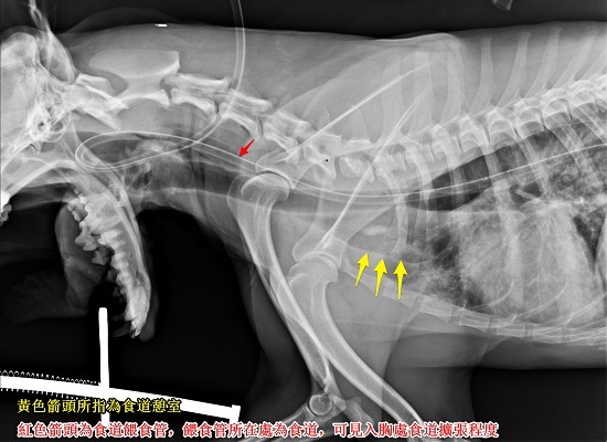 罕病『食道憩室』在X光片中可以清楚看到食道擴張的程度