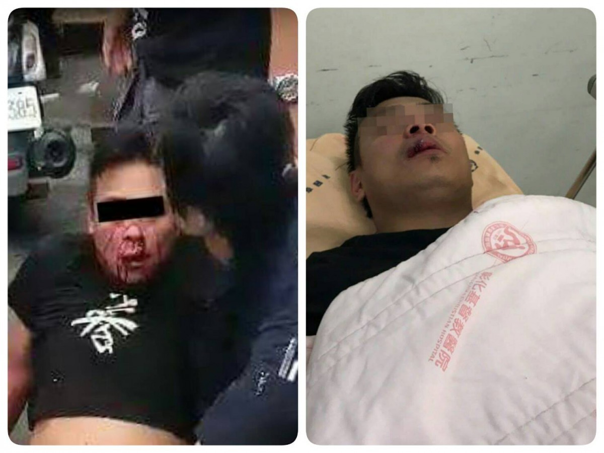 支持興建的動保志工被圍毆，滿臉是血。　取自我愛溪州 I Love Hsichou粉絲頁