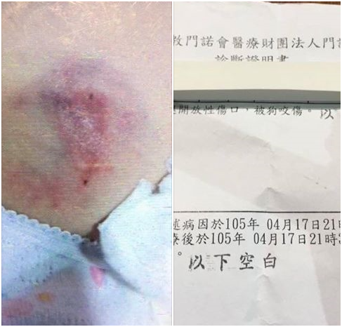 小女孩的傷口，和院方的診斷書。賴聖文/提供