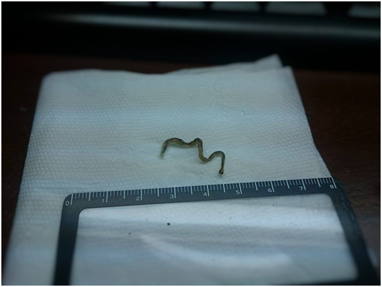 圖中為蛇體內的腸道寄生蟲乾，顯示飼主定期為寵物蛇驅蟲很重要。徐偉傑/提供
