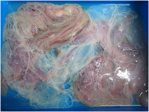 29日晚間7點左右，獸醫師替「小柚子」進一步醫檢，發現流產後的胎盤仍留在腹部尚未排出，於是緊急取出，因為死胎若過久會產生有毒物質從胎盤吸收，存留在鯨媽媽體內會導致母體死亡！ 中心助理吳小姐/攝