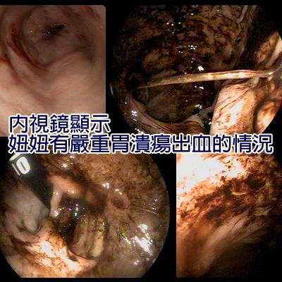 日前經檢查後發現妞妞有十二指腸及胃潰瘍,懷疑是因為伯伯以前曾多次餵止痛藥的緣故。 取自高雄市關懷流浪動物協會