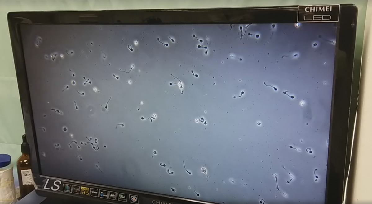 10月11日遭路殺的雄性水獺將睪丸送至台北市立動物園，預備做為未來如果真的需要人工繁殖時可以使用，而動物園也是第一次取得歐亞水獺的精子。　金門縣野生動物救援暨保育協會/提供