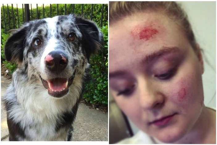 邊境牧羊犬弗林(左)是隻醫療警示犬,平時會提醒在飼主海莉(右)癲癇發作前提醒她。 取自The Dodo