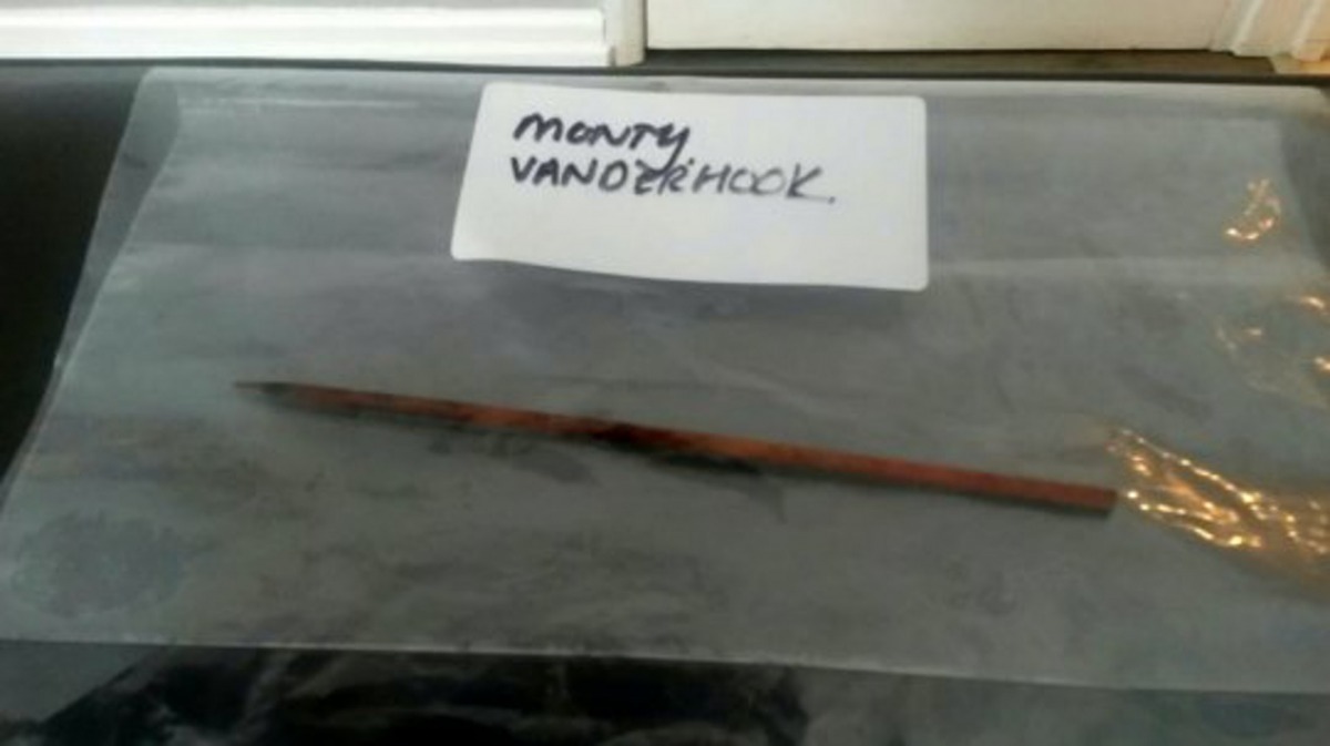 手術後拿出來的木籤,足有8英吋長。(SWNS)