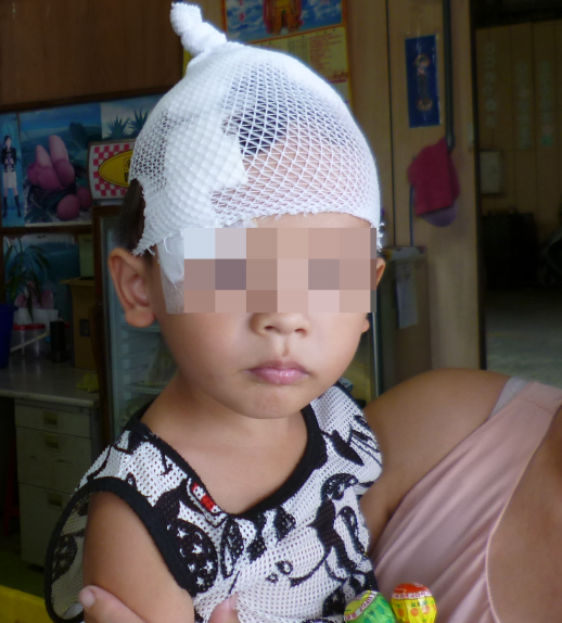 苗栗縣三義鄉一位3歲孩童在家中工廠被2隻流浪狗攻擊。　苗栗縣動物保護防疫所/提供