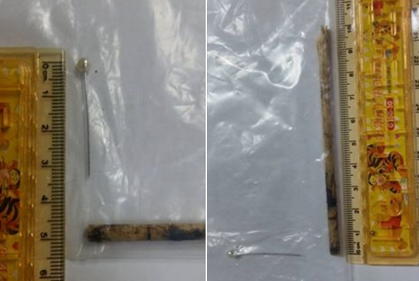 小貓右眼被插入的大頭針長3公分,插進肛門的竹筷則有10公分長。 張小姐提供