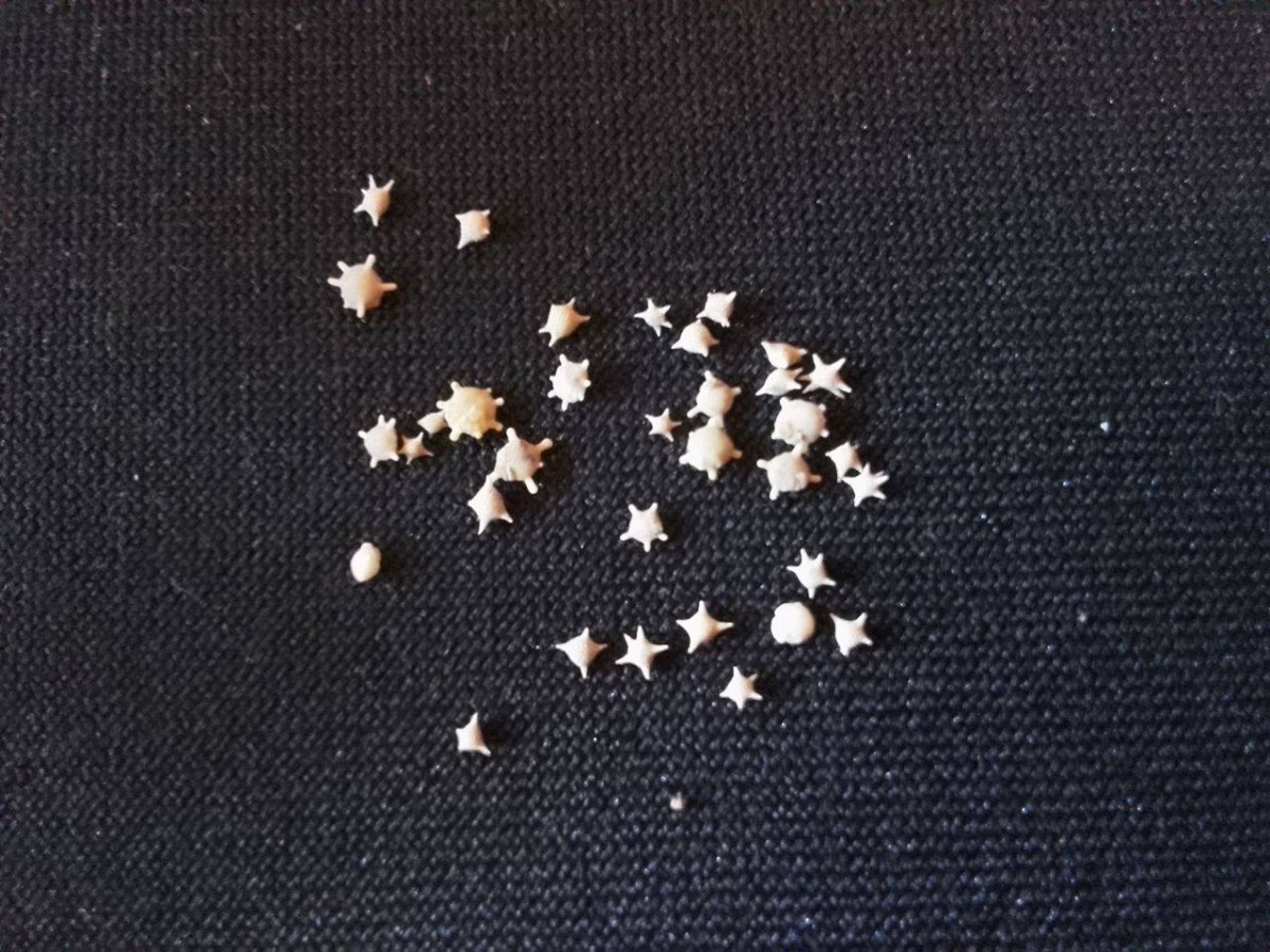 台灣的星砂有非常多種，可以分為四芒、五芒以及太陽形狀等等。 許雅婷/攝