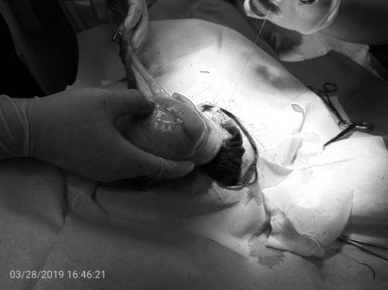 獸醫師手術切除棒球大的腫瘤。已變色處理，新北市動保處/提供