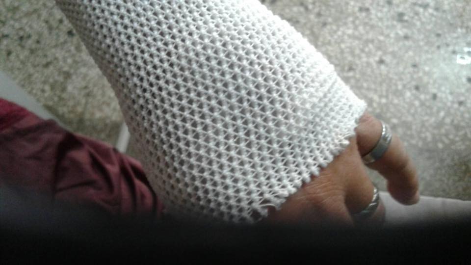 婦人遭獼猴攻擊造成手腕傷勢嚴重須住院觀察。 翻攝/爆料公社