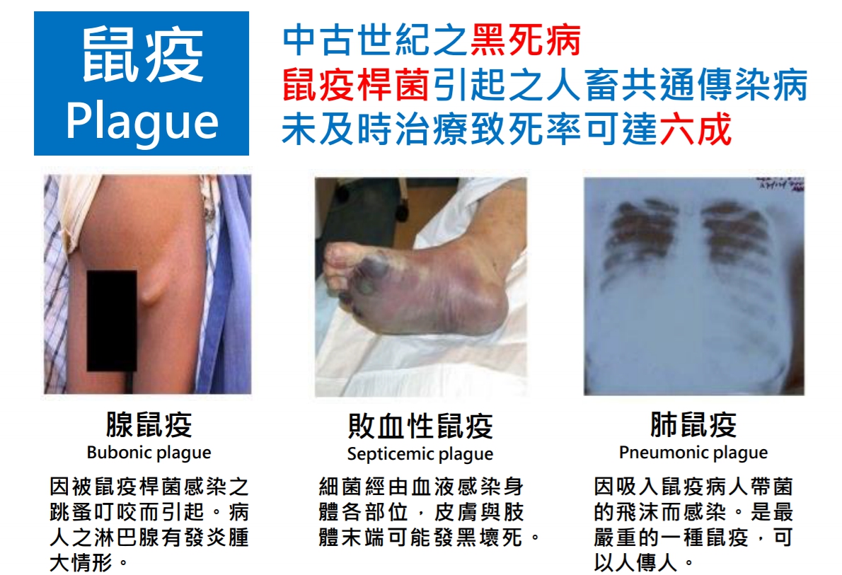 鼠疫為人畜共通傳染病，因此民眾應避免接觸囓齒類動物，也不要生食肉類或接觸動物死屍。 疾管署/提供